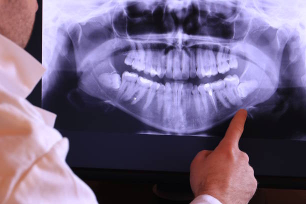 Best Emergency Root Canal Treatment in Powells Crossroads, TN
